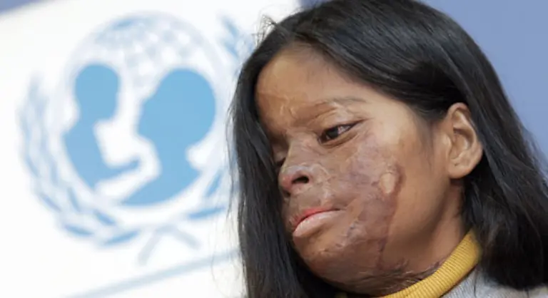 junge-Maedchen-in-Asien-mit-Saeure-uebergossen-chinesische-Kinder-Opfer-von-Entfuehrungen-und-Zwangsarbeit-in-Fabriken