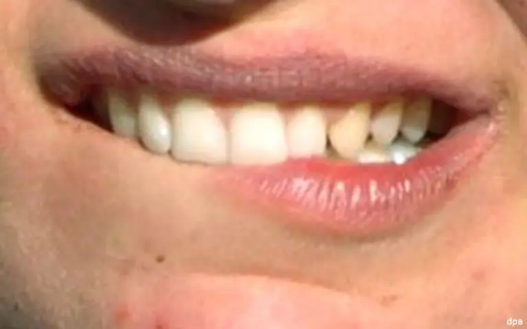 Sproede-Lippen-Der-Partner-weigert-sich-zu-kuessen-Vor-allem-im-Winter-koennen-die-Lippen-von-Wind-und-Kaelte-ganz-schoen-beansprucht-sein-Da-hilft