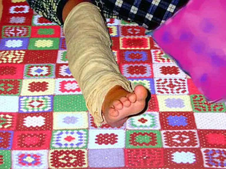 Der-Klassiker-bei-Fieber-Wadenwickel-Kalte-Umschlaege-um-beide-Unterschenkel-verringern-das-Fieber