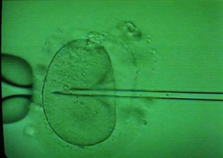 Bessergestellt-sind-Ehepaare-auch-in-einem-anderen-medizinischen-Bereich-Bei-Bedarf-uebernimmt-die-Krankenkasse-die-Kosten-einer-kuenstlichen-Befruchtung-zur-Haelfte-Nicht-Verheiratete-muessen-sich-ihren-Kinderwunsch-selbst-finanzieren