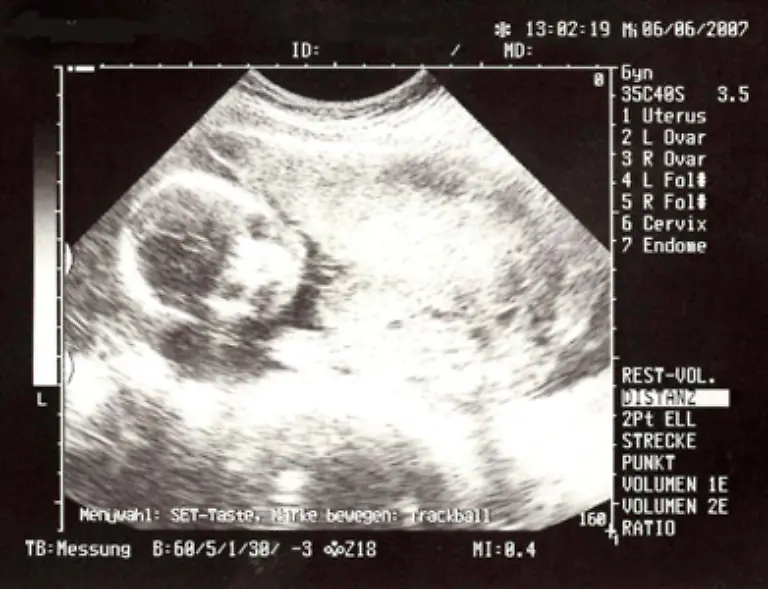 Viele-Paare-die-Heiraten-fuer-ueberfluessig-halten-aendern-ihre-Meinung-sobald-sich-Nachwuchs-ankuendigt-Denn-dann-macht-der-Ehestatus-vieles-unkomplizierter