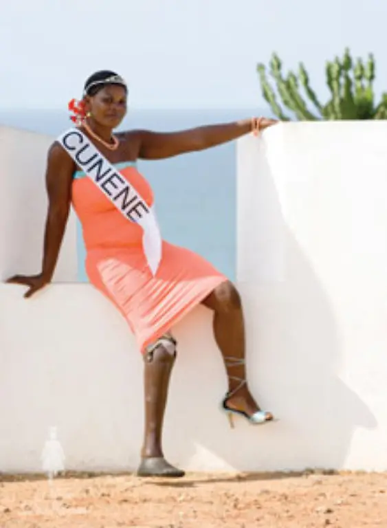 Severina-Cuhiela-26-verlor-ihr-Bein-bereits-1985-Die-Verkaeuferin-waere-gerne-Innenausstatterin-Dem-weissen-norwegischen-Initiator-Traavik-wurde-verschiedentlich-vorgeworfen-ein-ausbeuterisches-neokolonialistisches-Spiel-mit-den-schwarzen-mittellosen-und