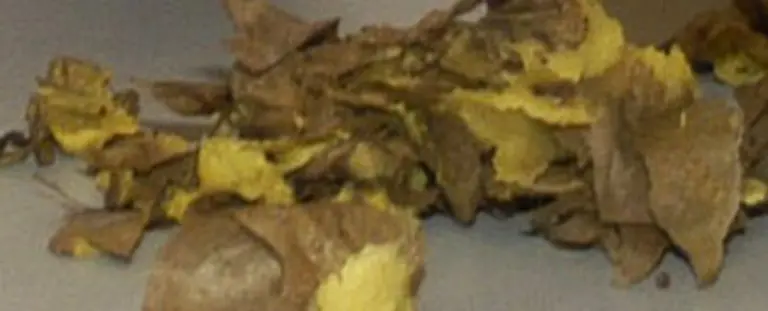 Wie-die-meisten-Deutschen-leidet-der-kleine-Otto-Hunger-im-Notfall-isst-er-auch-Kartoffelschalen-Am-Koerper-hat-er-Hungeroedeme-Das-hat-mich-damals-sehr-fasziniert-Das-Fleisch-wird-schwarz-Man-kann-es-herausschneiden-Die-Narben-habe-ich-heute-noch-sagt-Schily