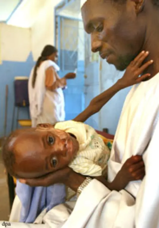 An-Erkrankungen-wie-Durchfall-Malaria-und-Unterernaehrung-sterben-laut-Chan-pro-Jahr-mehr-als-drei-Millionen-Menschen-auch-diese-Leiden-sind-zum-Teil-mit-dem-Klimawandel-verbunden
