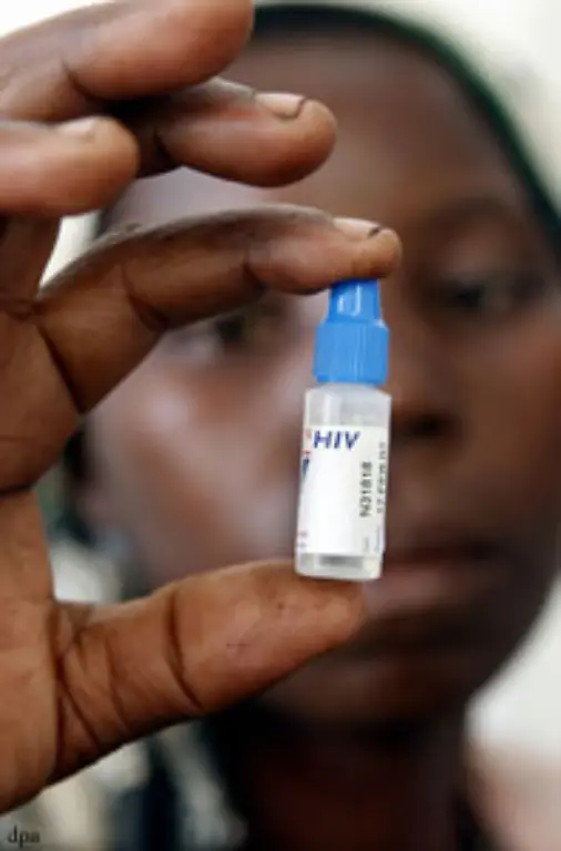 Fast-90-Prozent-aller-HIV-infizierten-Kinder-leben-in-Afrika-die-meisten-von-ihnen-angesteckt-durch-ihre-eigene-Mutter