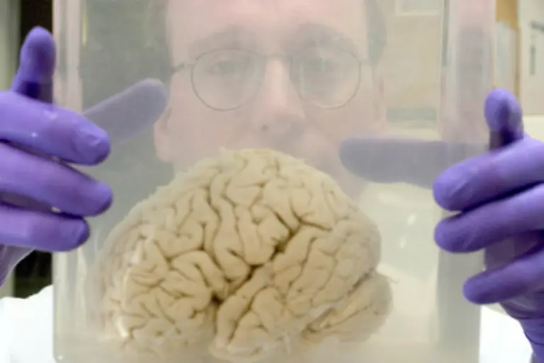 Die-Psychologie-hilft-weiter-Wir-haben-in-unserem-Gehirn-ein-Ueberraschungs-und-Belohnungssystem-das-reagiert-wenn-etwas-neu-und-unerwartet-ist-sagt-der-Konsumpsychologe-Haeusel