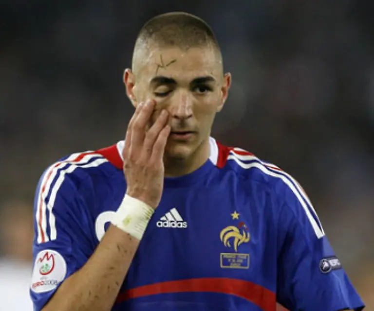 In-der-74-Minute-war-es-erneut-Benzema-der-fuer-Gefahr-vor-dem-italienischen-Tor-sorgte
