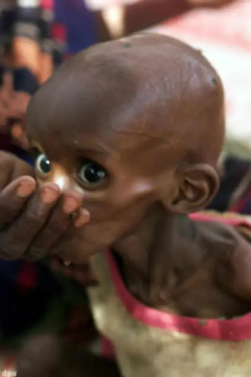 Das-Milleniumsziel-der-UN-die-Zahl-der-Menschen-ohne-Zugang-zu-sauberem-Wasser-bis-2015-zu-halbieren-liegt-noch-immer-in-weiter-Ferne