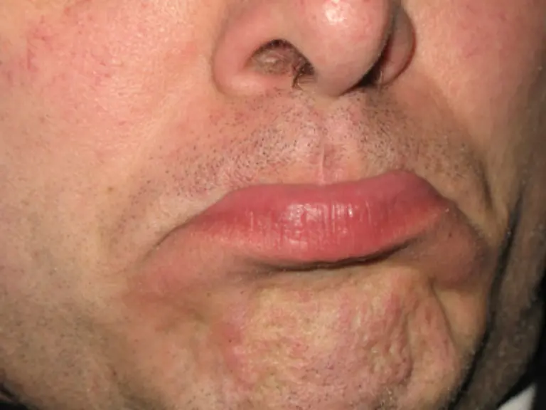 Doch-auch-wenn-der-Strand-dort-ist-wo-er-sein-soll-findet-sich-immer-ein-Grund-zum-noergeln