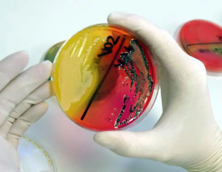 Kann-man-dagegen-nachweisen-dass-das-Hotelessen-eine-Salmonelleninfektion-verursacht-hat-ist-durchaus-eine-Entschaedigung-drin