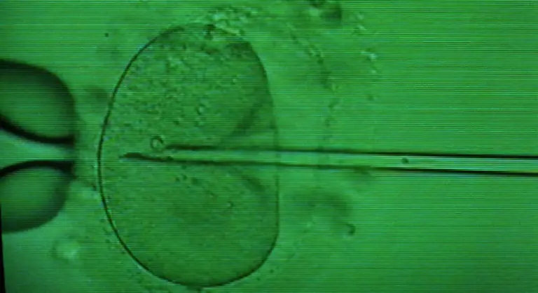 Die-katholische-Kirche-sah-in-der-sogenannten-In-Vitro-Fertilisation-IVF-allerdings-einen-Angriff-auf-die-Schoepfung-Ethiker-befuerchteten-dass-der-Schritt-zum-Menschen-Klonen-nun-nur-noch-ein-kleiner-sei