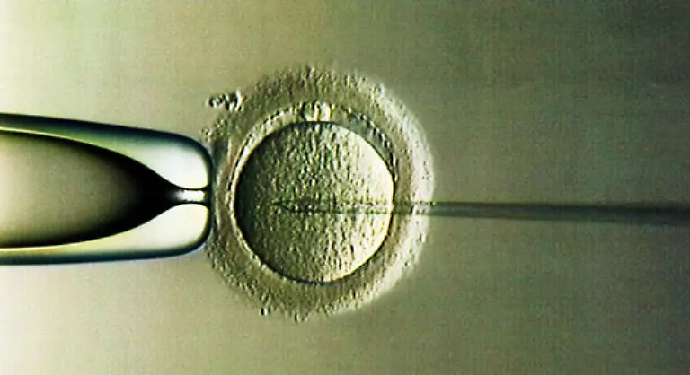 Trotz-der-Hoffnung-die-Browns-Geburt-vielen-Paaren-gegeben-hat-Eine-kuenstliche-Befruchtung-ist-immer-noch-ein-extremer-Eingriff-eine-komplizierte-emotional-und-koerperlich-herausfordernde-Prozedur-wie-Mike-Macnamee-Chef-der-Bourn-Hall-Klinik-in-Cambridgeshire-betont