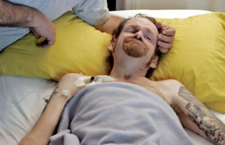 Moegliche-Nebenwirkungen-sind-paranoide-Wahnvorstellungen-latente-Schizophrenie-Aggressivitaet-Schlafstoerungen-Akne-Gewichtsverlust