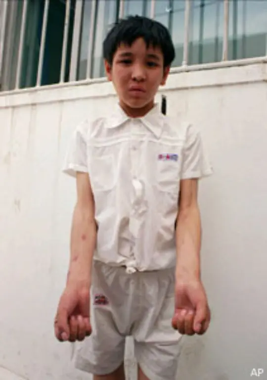 Viele-unterschaetzen-die-gesundheitlichen-und-psychischen-Nebenwirkungen-und-die-drohende-Abhaengigkeit-die-bis-zum-Tode-fuehren-kann