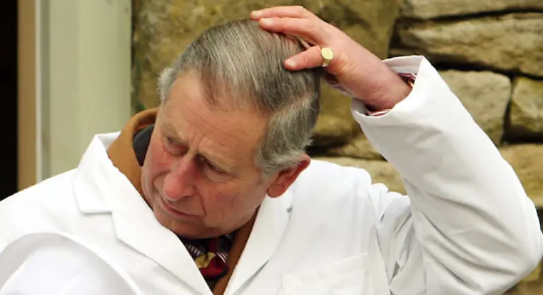 Manchmal-hat-er-sowas-wie-Phantom-Schmerzen-Dann-tastet-er-an-seinem-Kopf-herum-und-wundert-sich-warum-sie-da-nicht-ist