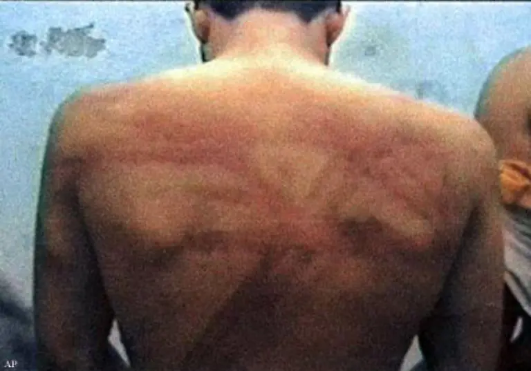 Folter-und-Misshandlungen-gibt-es-laut-amnesty-international-in-mehr-als-100-Laendern