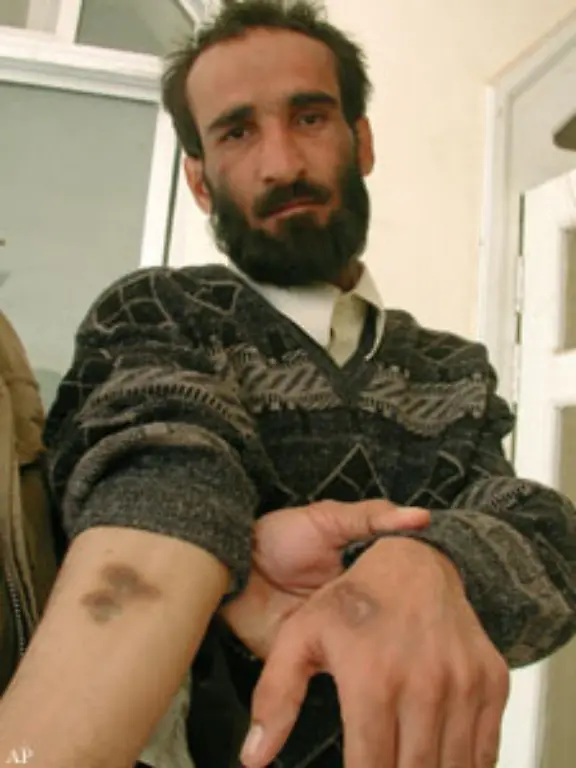 Die-Internationale-Schutztruppe-ISAF-unterstuetzt-laut-amnesty-international-ebenfalls-indirekt-Folter-Die-Kritik-Verdaechtige-die-den-afghanischen-Behoerden-uebergeben-werden-droht-die-Folter