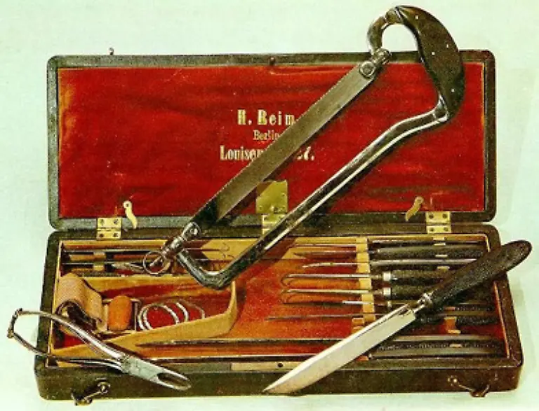 die-grausamen-Zustaende-beim-Operieren-zur-damaligen-Zeit-denn-die-Narkose-war-noch-nicht-erfunden-brach-er-sein-Studium-1827-ab-Amputationswerkzeuge-aus-dem-19