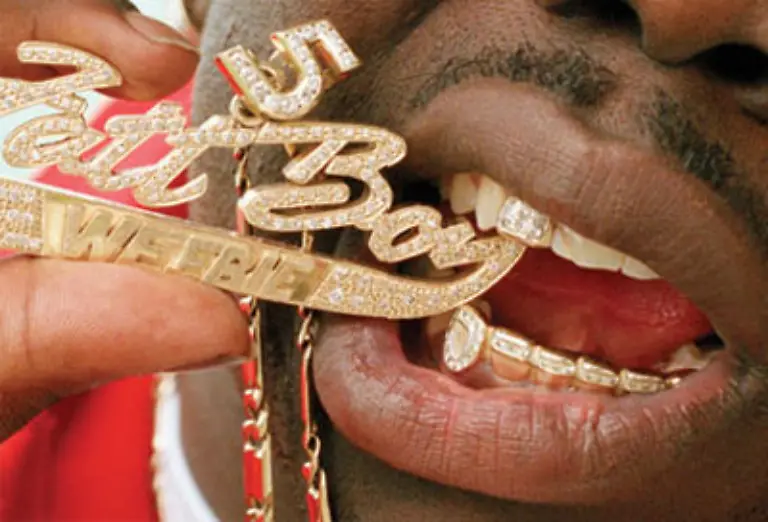 Was-fuer-manche-ein-Muss-ist-fuer-andere-nur-Schmuck-Manche-Rapper-tragen-Gold-als-Symbol-dafuer-dass-auch-Strassenkids-es-zu-etwas-bringen-koennen-ohne-medizinische-Gruende-im-Mund