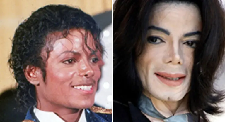 Und-eine-Veraenderung-des-Aeusseren-die-selbst-den-gluehendsten-Fans-zum-Schluss-unheimlich-war