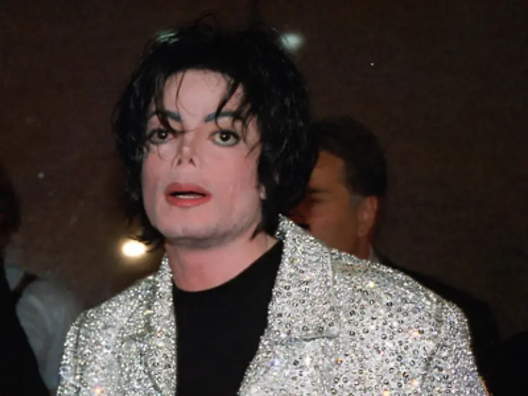 1993-gibt-er-in-einem-Interview-mit-Oprah-Winfrey-zu-dass-er-sich-kosmetischen-Operationen-unterzogen-habe-Da-er-beim-Dreh-zu-einem-Pepsi-Werbespot-Verbrennungen-erlitten-habe-seien-die-Eingriffe-an-Kinn-Nase-und-Kopf-notwendig-gewesen