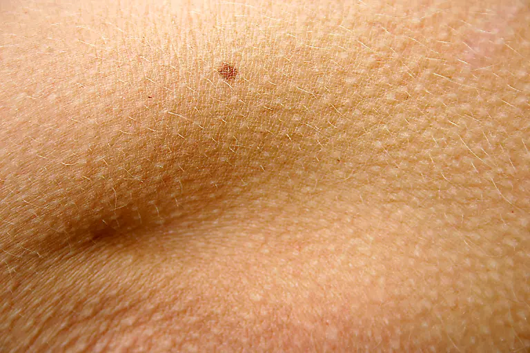 89988-R-K-by-Alexandra-Bucurescu-pixelio-de