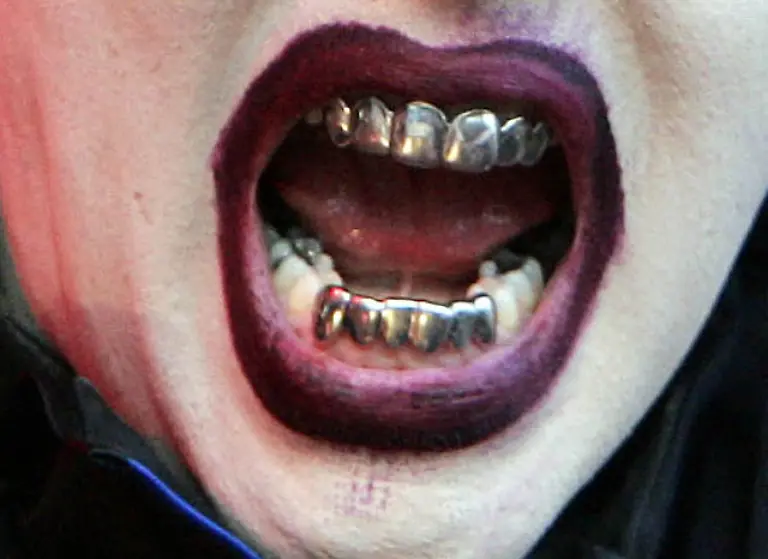 mansonzaehne