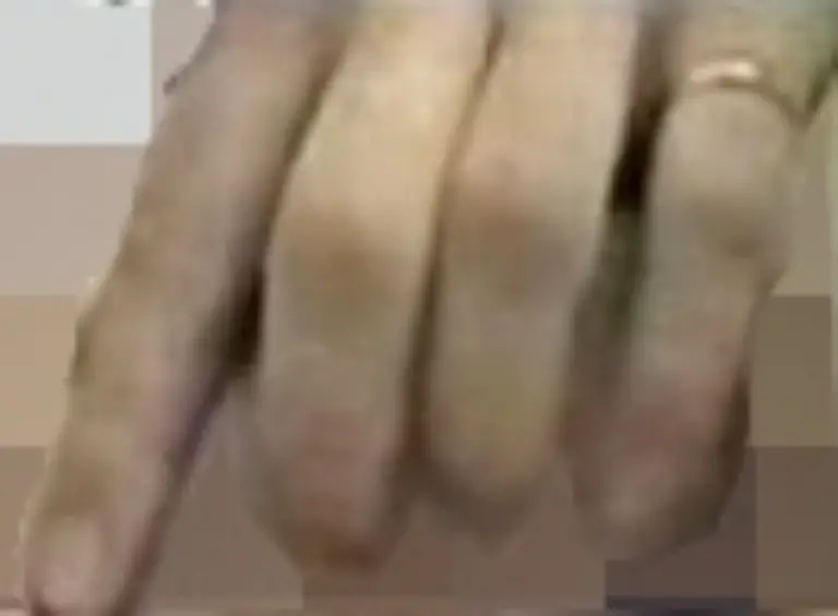 taeter2-finger2