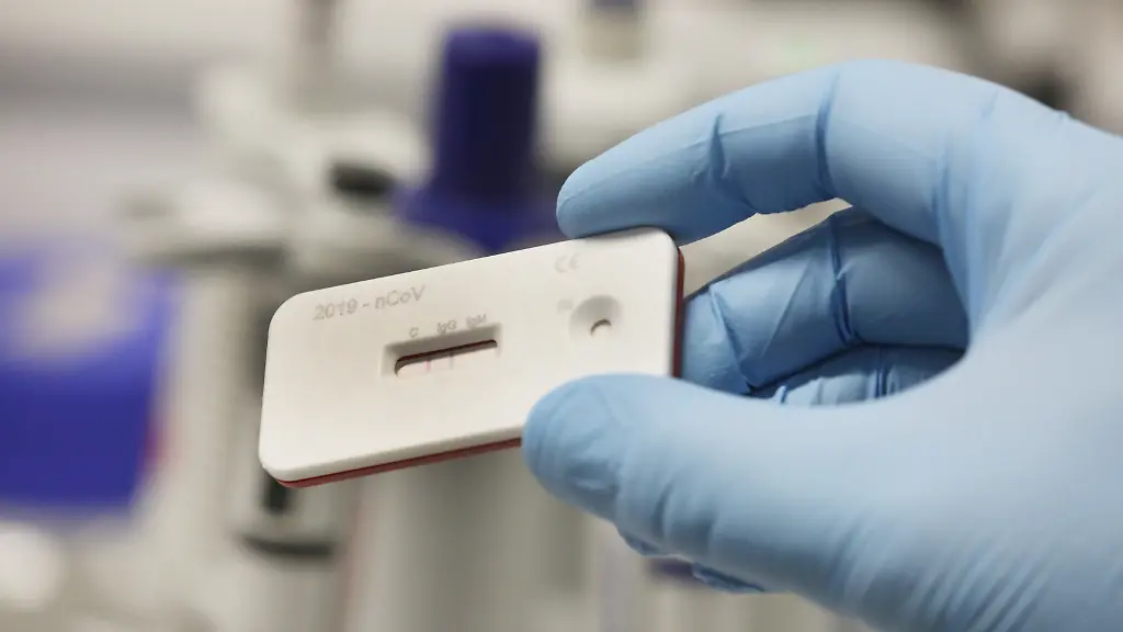 Ein-Wissenschaftler-zeigt-einen-Corona-Schnelltest-im-Leibnitz-Institut-fuer-Photonische-Technologien