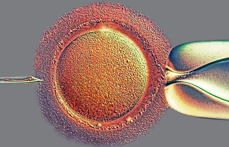 Intracytoplasmic-Sperm-Injection