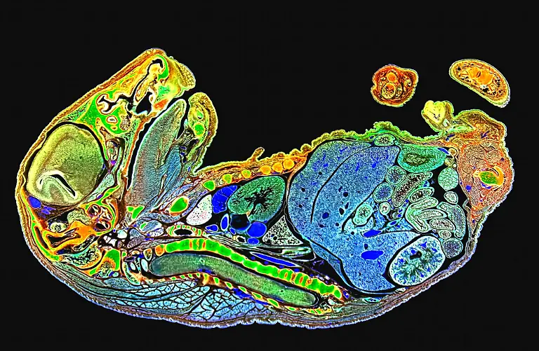 19mm-mouse-foetus-longitudinal-section