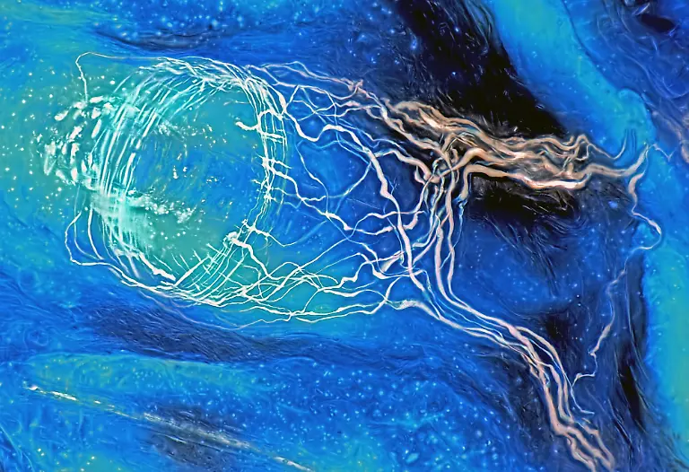 Basket-of-sensory-fibres-around-hair-follicle