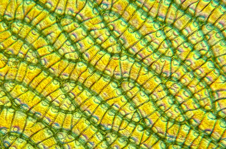 Cells-of-Sphagnum-leaf-DIC