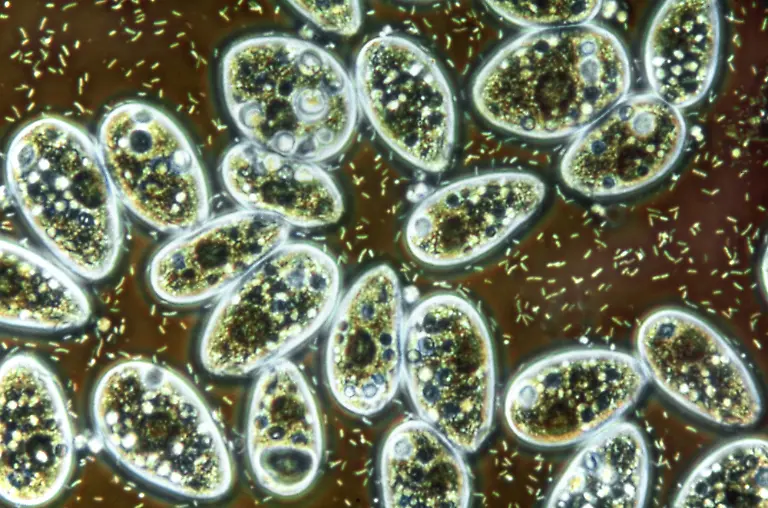 Bacteria-and-ciliate-protozoa-in-flower-vase-water