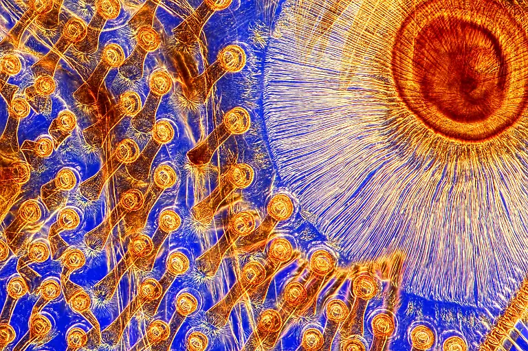 Male-Dytiscus-beetle-tarsal-suckers