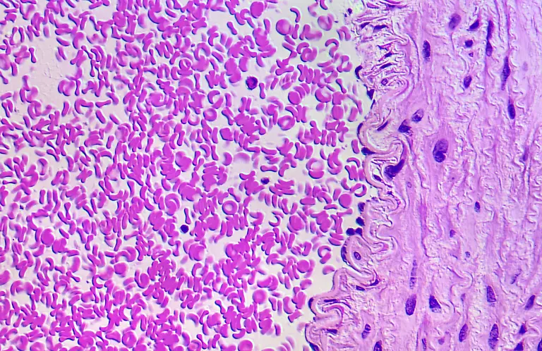 Artery-lining-and-blood-thin-section