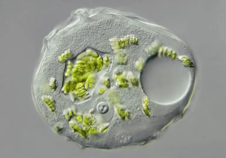 Thecamoeba-a-freshwater-Rhizopod-Protozoan