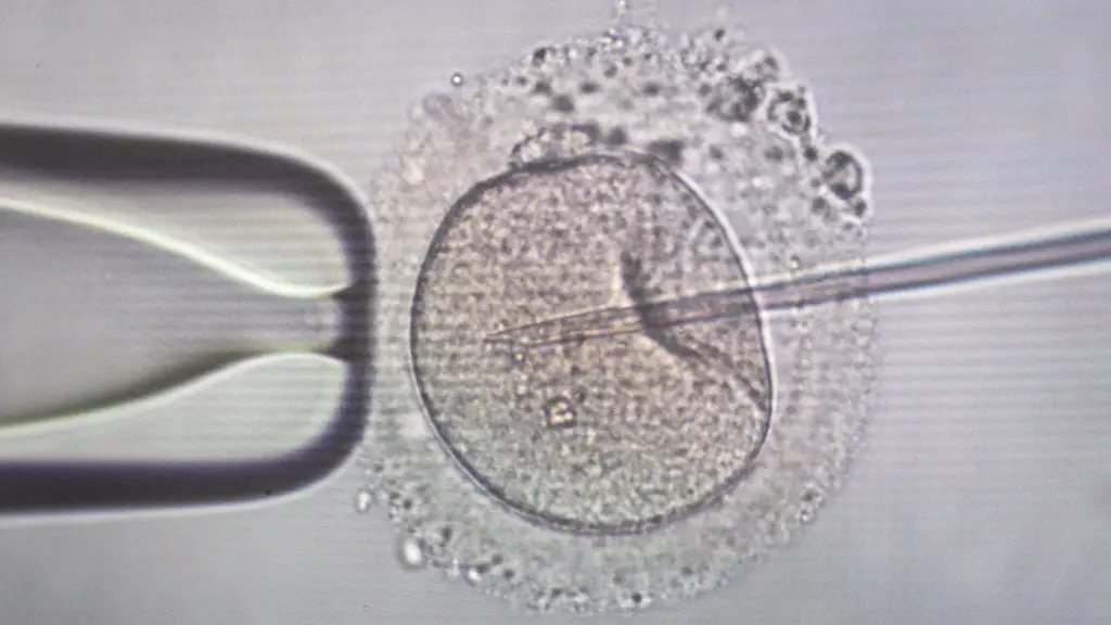 Die-kuenstliche-Befruchtung-ist-eine-Moeglichkeit-fuer-ungewollt-kinderlose-Paare