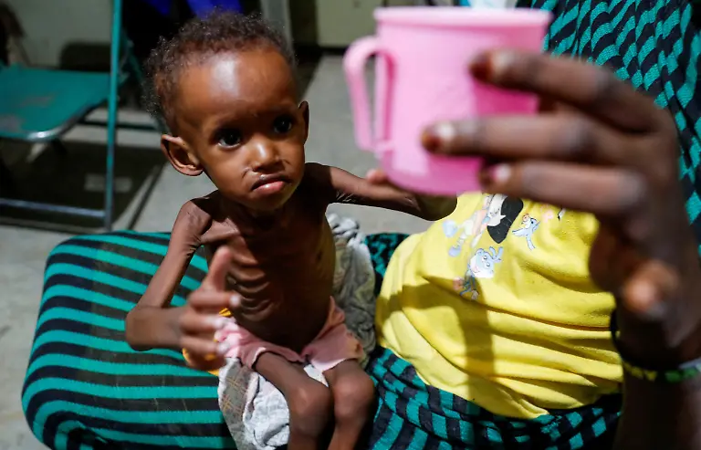 FILE-PHOTO-SENSITIVE-MATERIAL-THIS-IMAGE-MAY-OFFEND-OR-DISTURB-Saddam-Najwa-a-malnourished-17-month-old-internally-displaced-child-reaches-out-for-a-cup-of-water-at-the-paediatric-ward-of-the-Mother-of-Mercy-Hospital-in-Gidel-near-Kauda-within-the-Sudan-s-People-Liberation-Movement-North-SPLM-N-controlled-area-of-the-Nuba-Mountains-South-Kordofan-Sudan-June-25-2024