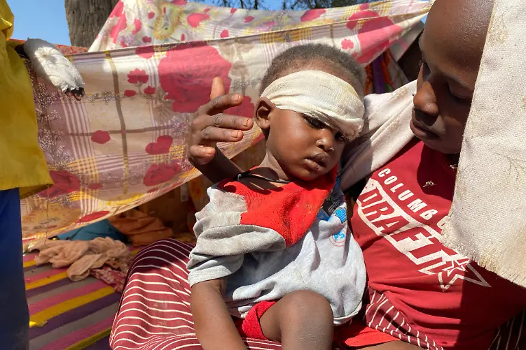 FILE-A-Sudanese-child-who-fled-el-Fasher-city-with-family-after-Sudan-s-paramilitary-forces-attacked-the-western-Darfur-region-receives-treatment-at-a-camp-in-Tawila-Sudan-Nov-2-2025