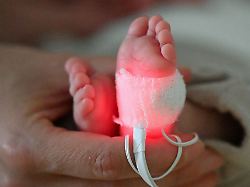 Niedersachsen & Bremen: Erreger im Krankenhaus - Frühchen stirbt