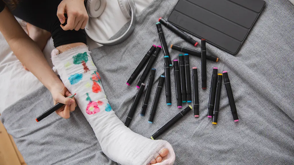 Frau-malt-auf-gebrochenem-Bein-mit-Gipsverband-Unbekanntes-Maedchen-malt-mit-Filzstiften-auf-orthopaedischem-Gipsverband-Gelangweilte-Maedchen-mit-gebrochenem-Bein-spielt-zu-Hause-waehrend-der-Rehabilitation-Behandlung-einer-Unfallverletzung-mit-Knochenbru-Woman-hands-drawing-on-broken-leg-cast-Unrecognizable-girl-draws-with-felt-tip-pens-on-orthopedic-cast-Bored-girl-with-broken-leg-playing-at-home-during-rehabilitation-Accident-injury-fracture-treatment-LicenseRF-model-released-Symbolfoto-Copyright-xZoonar