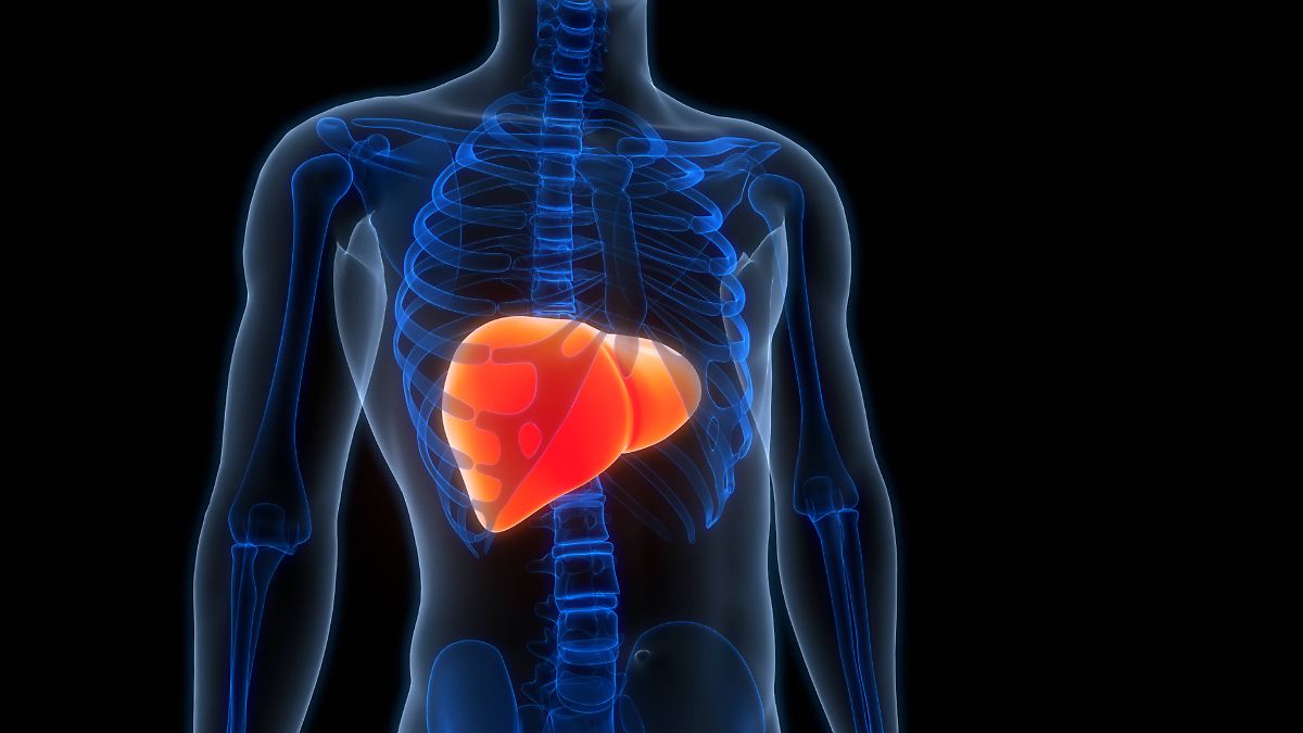 Wissenschaftler mit düsterer Prognose: Fettleber wird weltweit zur Volkskrankheit 