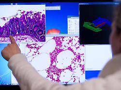 Rheinland-Pfalz & Saarland: Krebs und Kreislauferkrankungen häufigste Todesursachen