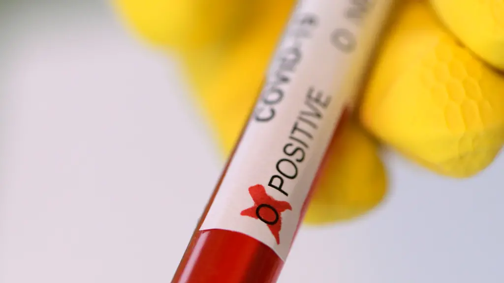 1cf90036669503e608aa280febf62bf6