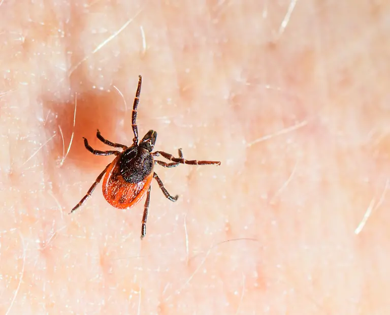 Der-Gemeine-Holzbock-Ixodes-ricinus-krabbelt-ueber-die-Haut-einer-Person-Der-Holzbock-ist-die-Zeckenart-die-Borrelien-und-FSME-Viren-auf-Mensch-und-Tier-uebertragen-kann