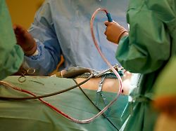 Hamburg & Schleswig-Holstein: Klinik-Abrechnungen: Kontrollen werden verschärft