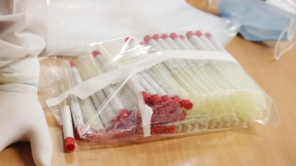 Testroehrchen-fuer-den-Covid-19-Test-liegen-an-einer-Corona-Teststelle-am-Flughafen-Erfurt-Weimar