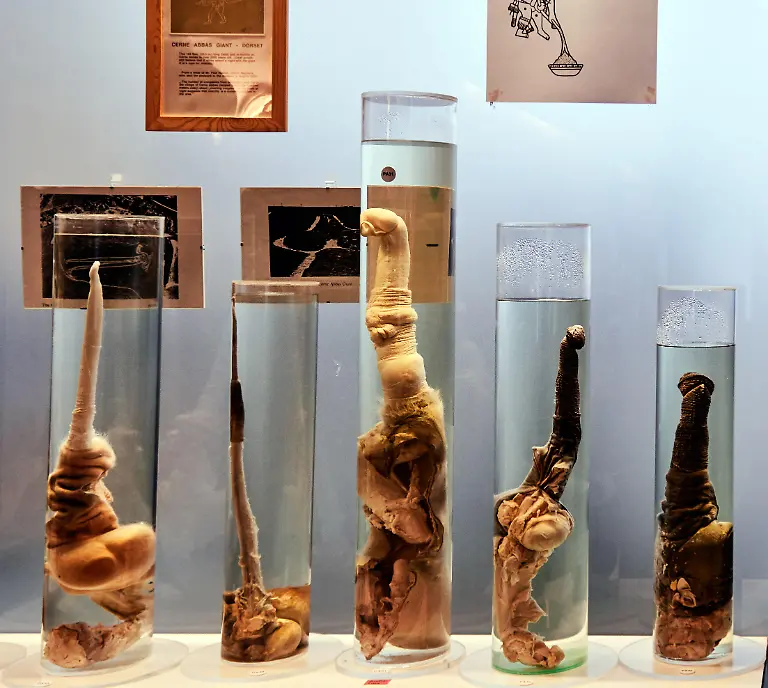 Reykjavik-The-Icelandic-Phallological-Museum-is-probably-the-only-museum-in-the-world-to-contain-a-collection-of-phallic-specimens-belonging-to-all-the-various-types-of-mammal-found-in-a-single-country-It-contains-a-collection-of-more-than-two-hundred-and-fifteen-penises-and-penile-parts-belonging-to-almost-all-the-land-and-sea-mammals-that-can-be-found-in-Iceland-including-specimens-from-Homo-Sapiens-Das-islaendische-Phallological-Museum-ist-wahrscheinlich-das-einzige-Museum-in-der-Welt-um-eine-Sammlung-von-phallischen-Mustern-zu-enthalten-die-allen-verschiedenen-Typen-des-in-einem-einzelnen-Land-gefundenen-Saeugetiers-gehoeren-Es-enthaelt-eine-Sammlung-von-mehr-als-zweihundertfuenfzehn-Penissen-und-penile-Teilen-die-fast-allen-Land-und-Seesaeugetieren-gehoeren-die-in-Island-einschliesslich-Muster-vom-Homo-Sapiens-gefunden-werden-koennen