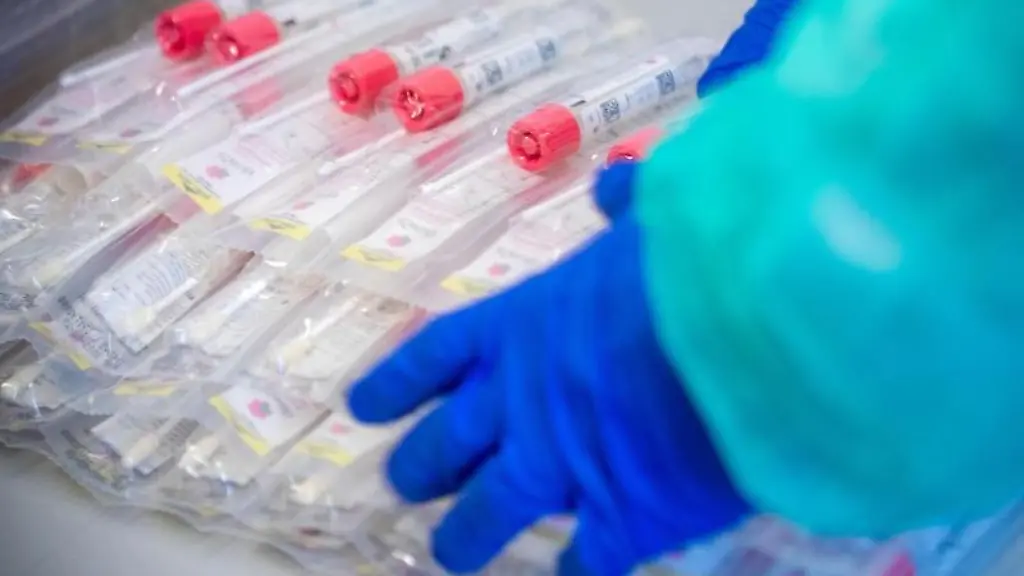 Corona-Testsets-mit-Abstrichstaebchen